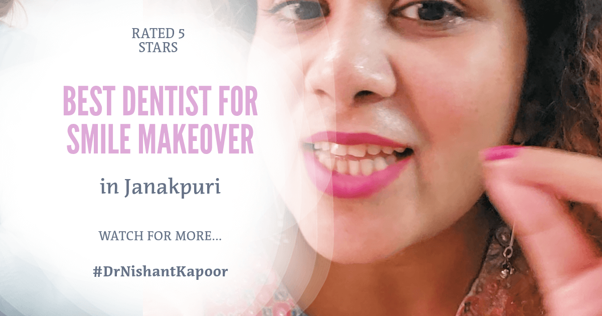 Smile Makeover Review